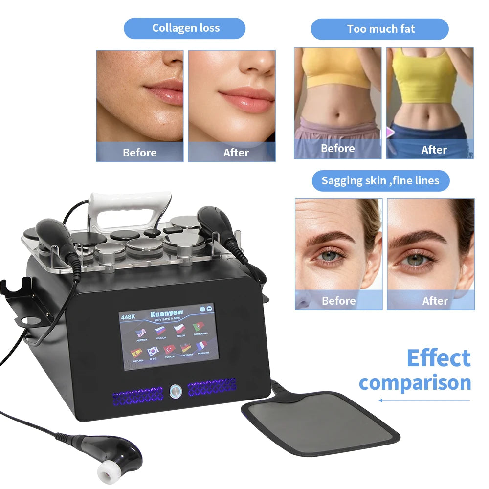 INDIBA 448Khz Thermal Therapy Technology Beauty Machine Body Care Face Lifting Relieve Pains Lose Weight SPA Device Skin Firming
